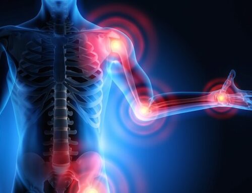 The Efficacy Of Using CBD To Manage Inflammation